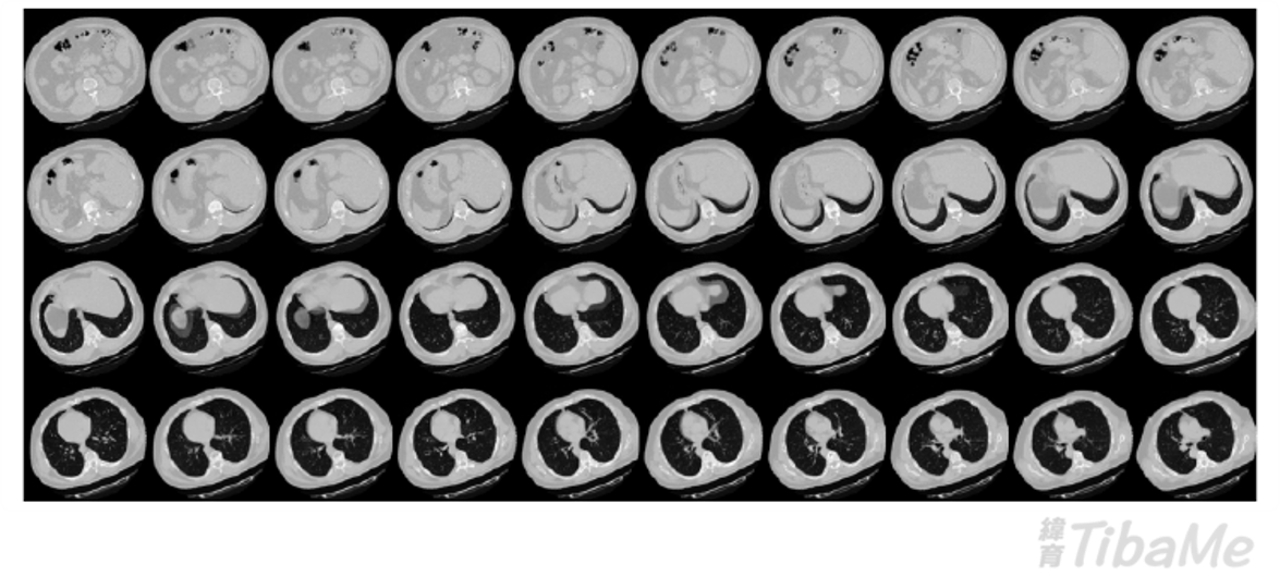 醫療ai大進化 精準醫療 高國慶醫師資訊收集站線粒體prp長壽蛋白端粒酶排毒水針刀41度c 隨意窩xuite日誌